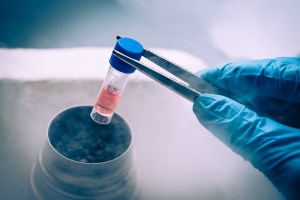 stem cells from wisdom teeth